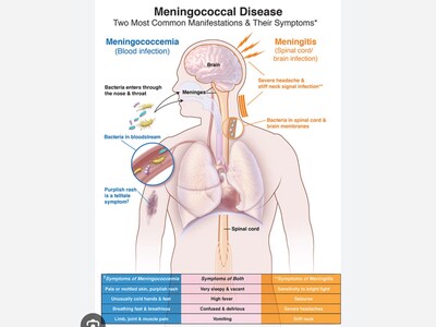 Meningococcal Disease on the Rise per CDC Advisory, New Mexico Vaccination Requirements