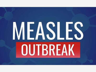 Measles Case Now Reported in San Juan County, New Mexico